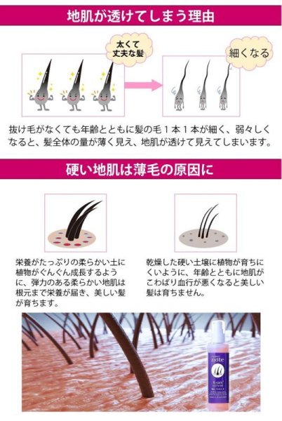 画像9: 気になる抜け毛・薄毛に スカルプケアローション ケケアケア お得な詰め替え400ml 地肌が喜ぶスカルプケア。加齢やホルモンバランスの乱れによる髪の悩みに着目した、幹細胞・キャピキシル配合のスカルプケアローションです (9)